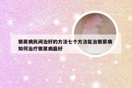 银屑病民间治好的方法七个方法能治银屑病 如何治疗银屑病最好