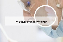 中华秘方网牛皮癣 中华秘方网