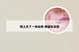 跨上长了一块白斑 胯部长白斑