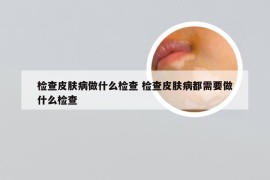 检查皮肤病做什么检查 检查皮肤病都需要做什么检查