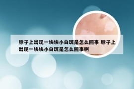 脖子上出现一块块小白斑是怎么回事 脖子上出现一块块小白斑是怎么回事啊