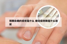 初期白癫的症状是什么 癫狂痫初期是什么症状