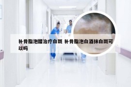 补骨脂泡醋治疗白斑 补骨脂泡白酒抹白斑可以吗