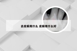 去皮癣用什么 皮癣用什么好