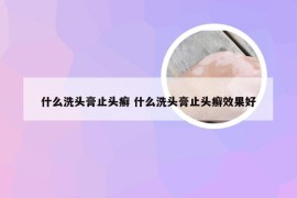 什么洗头膏止头癣 什么洗头膏止头癣效果好