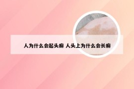 人为什么会起头癣 人头上为什么会长癣