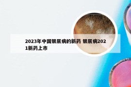 2023年中国银屑病的新药 银屑病2021新药上市