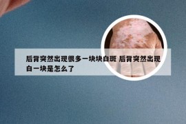 后背突然出现很多一块块白斑 后背突然出现白一块是怎么了