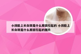 小孩脸上长白斑是什么原因引起的 小孩脸上长白斑是什么原因引起的图片