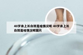 40岁身上长白斑是啥情况呢 40岁身上长白斑是啥情况呢图片