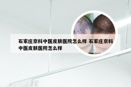 石家庄京科中医皮肤医院怎么样 石家庄京科中医皮肤医院怎么样