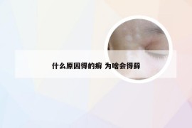 什么原因得的癣 为啥会得藓