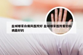 盐城哪家白癜风医院好 盐城哪家医院看妇科病最好的