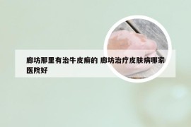 廊坊那里有治牛皮癣的 廊坊治疗皮肤病哪家医院好