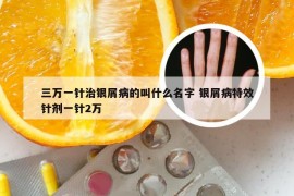 三万一针治银屑病的叫什么名字 银屑病特效针剂一针2万