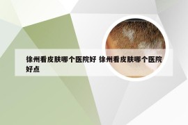 徐州看皮肤哪个医院好 徐州看皮肤哪个医院好点