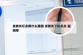 皮肤长红点痒什么原因 皮肤长了红点点 超级痒