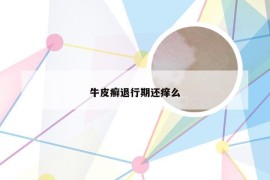 牛皮癣退行期还痒么