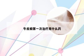 牛皮癣第一次治疗用什么药