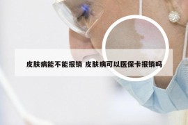 皮肤病能不能报销 皮肤病可以医保卡报销吗