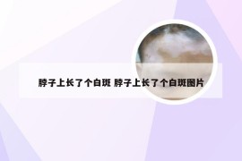 脖子上长了个白斑 脖子上长了个白斑图片