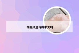 白癜风遗传概率大吗