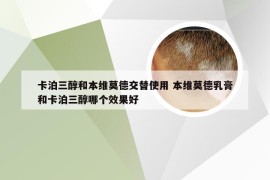 卡泊三醇和本维莫德交替使用 本维莫德乳膏和卡泊三醇哪个效果好