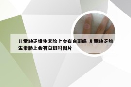 儿童缺乏维生素脸上会有白斑吗 儿童缺乏维生素脸上会有白斑吗图片