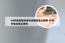 44岁就有很多老年白斑是怎么回事 40多岁有白斑正常吗