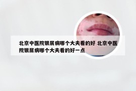 北京中医院银屑病哪个大夫看的好 北京中医院银屑病哪个大夫看的好一点