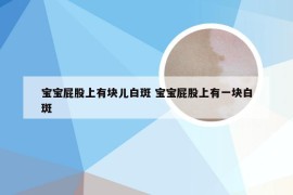 宝宝屁股上有块儿白斑 宝宝屁股上有一块白斑