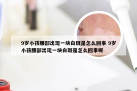 9岁小孩腰部出现一块白斑是怎么回事 9岁小孩腰部出现一块白斑是怎么回事呢