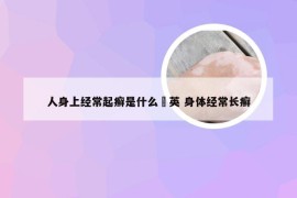 人身上经常起癣是什么蒝英 身体经常长癣