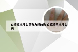 白癫疯吃什么药有力好的快 白疯癫风吃什么药