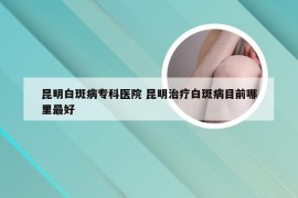 昆明白斑病专科医院 昆明治疗白斑病目前哪里最好