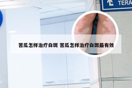 苦瓜怎样治疗白斑 苦瓜怎样治疗白斑最有效