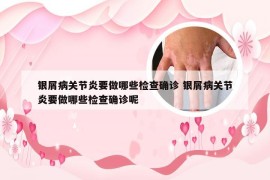 银屑病关节炎要做哪些检查确诊 银屑病关节炎要做哪些检查确诊呢