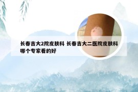 长春吉大2院皮肤科 长春吉大二医院皮肤科哪个专家看的好