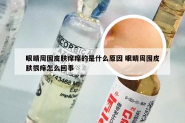 眼睛周围皮肤痒痒的是什么原因 眼睛周围皮肤很痒怎么回事