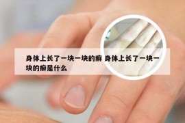 身体上长了一块一块的癣 身体上长了一块一块的癣是什么