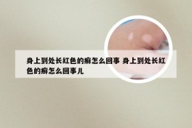 身上到处长红色的癣怎么回事 身上到处长红色的癣怎么回事儿