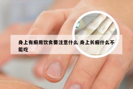 身上有癣用饮食要注意什么 身上长癣什么不能吃