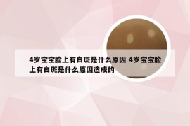 4岁宝宝脸上有白斑是什么原因 4岁宝宝脸上有白斑是什么原因造成的