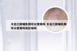 卡泊三醇哺乳期可以使用吗 卡泊三醇哺乳期可以使用吗有影响吗