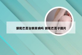 狼尾巴蒿治银屑病吗 狼尾巴蒿子图片