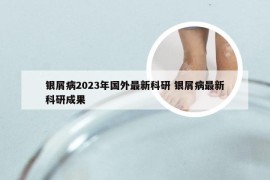 银屑病2023年国外最新科研 银屑病最新科研成果