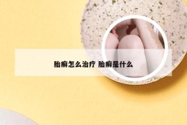 胎癣怎么治疗 胎癣是什么