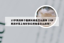 15岁男孩两个胳膊长癣是怎么回事 15岁男孩手臂上有好多红疙瘩是怎么回事?