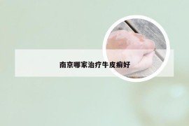 南京哪家治疗牛皮癣好