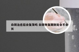 白斑治愈后会复发吗 白斑恢复期别处会不会长